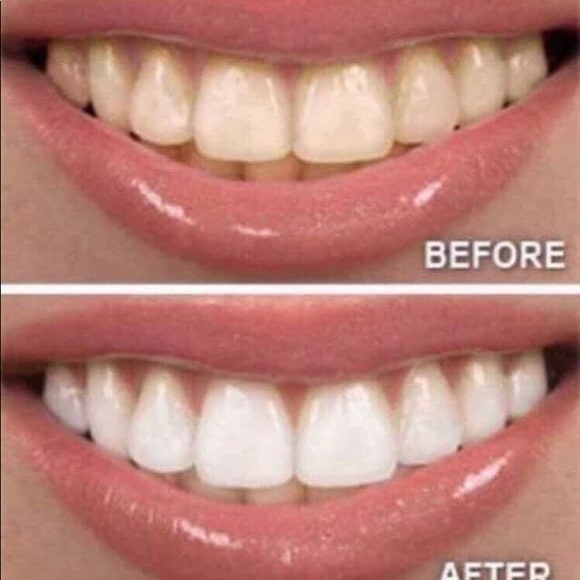 THE BEST Whitening Toothpaste!  NO HARSH CHEMICALS - Picture 6 of 12
